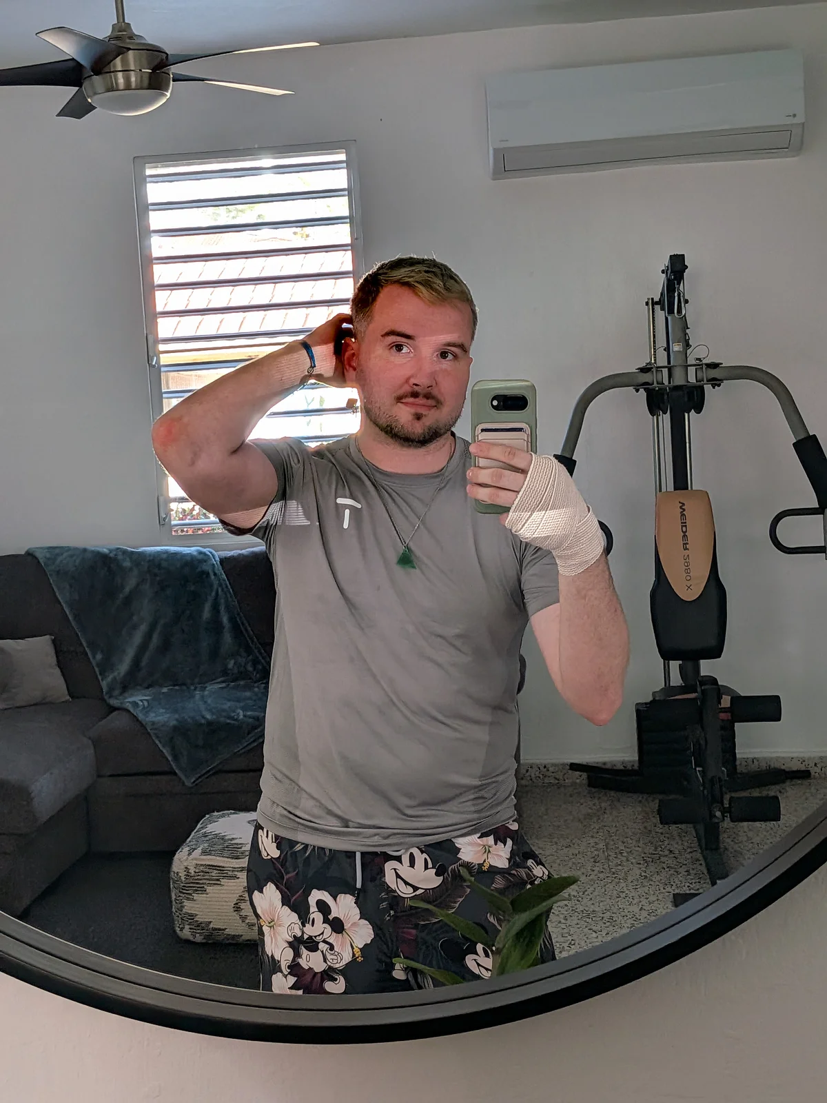 Mirror selfie at the Boquerón Airbnb — bandaged hand