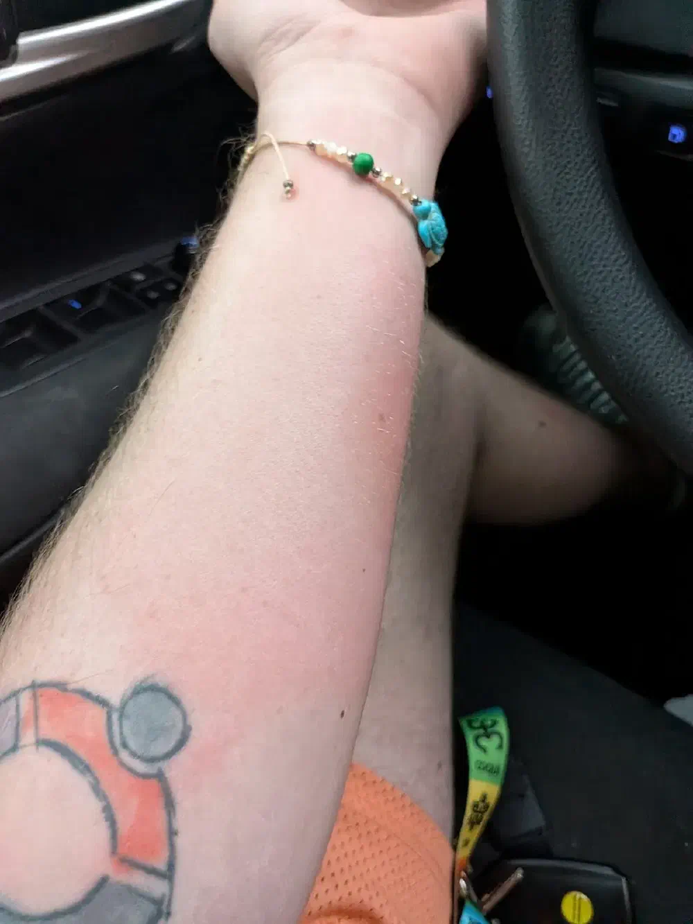 The arm — red, scraped, bitten